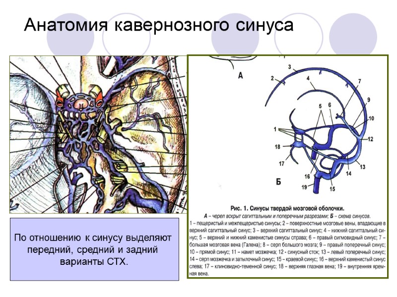 Анатомия кавернозного синуса По отношению к синусу выделяют  передний, средний и задний 